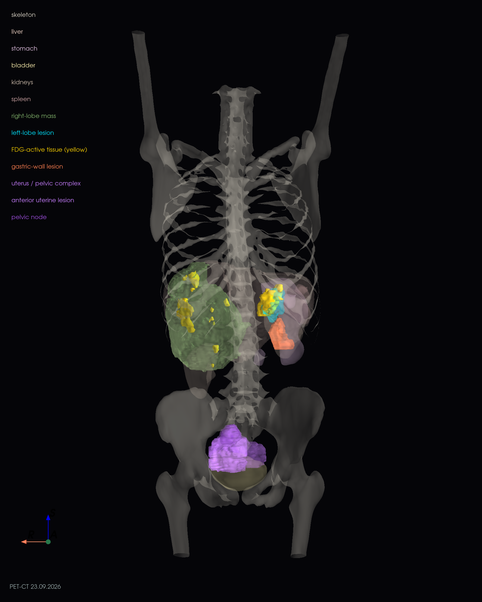 anterior