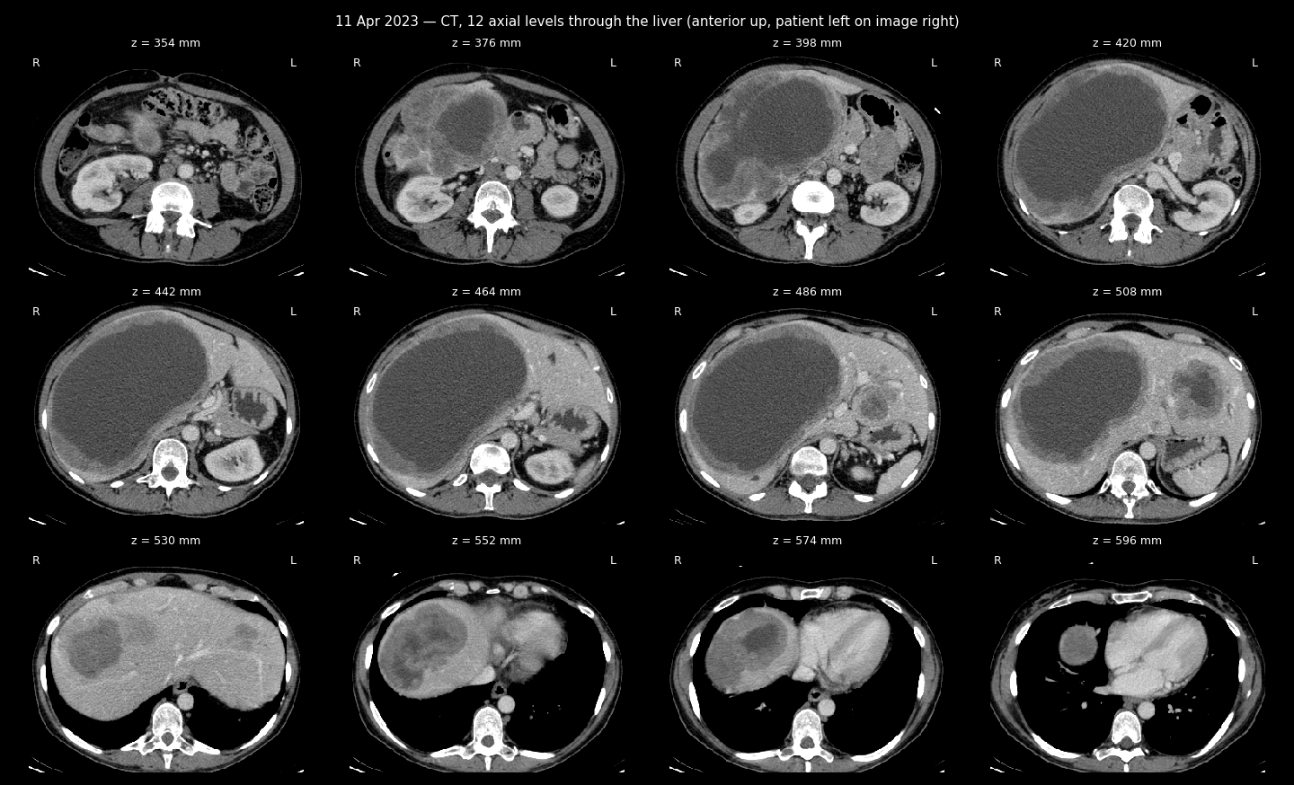CT sheet