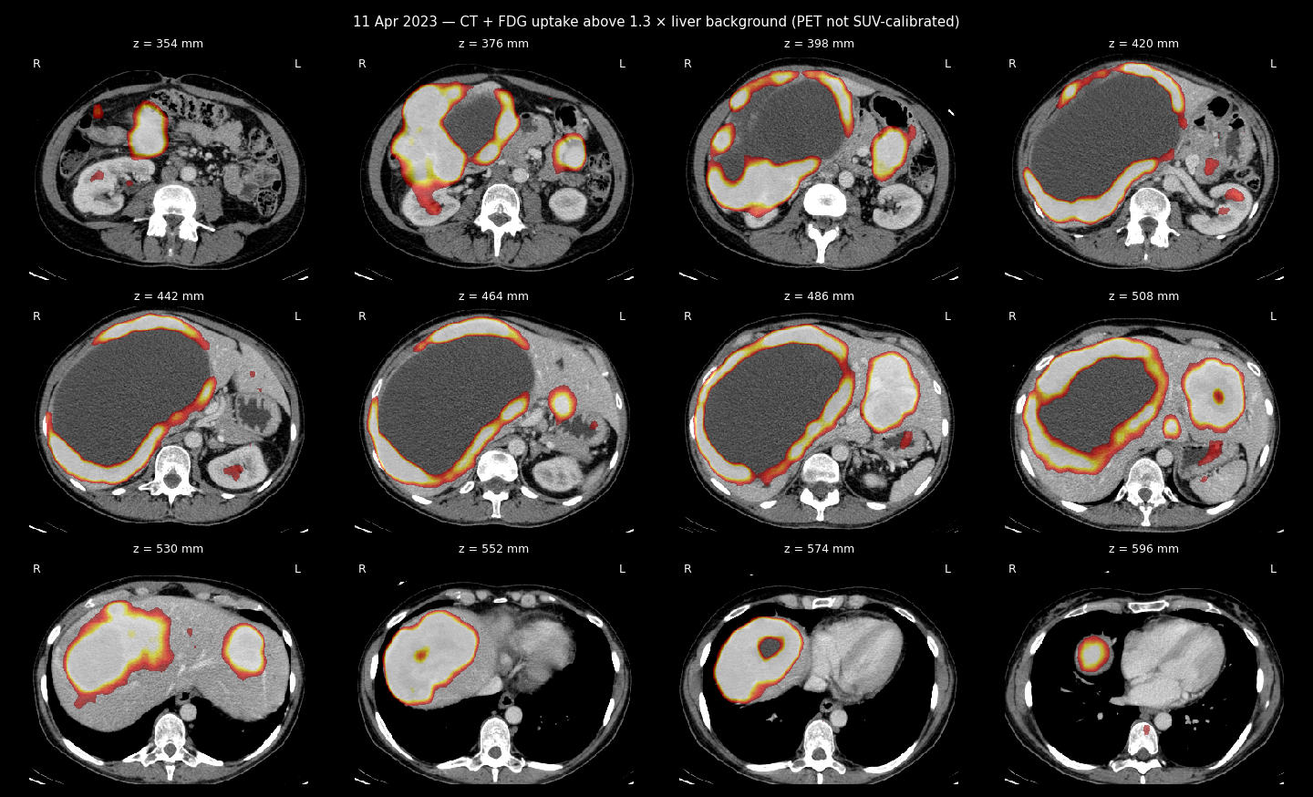 PET/CT sheet