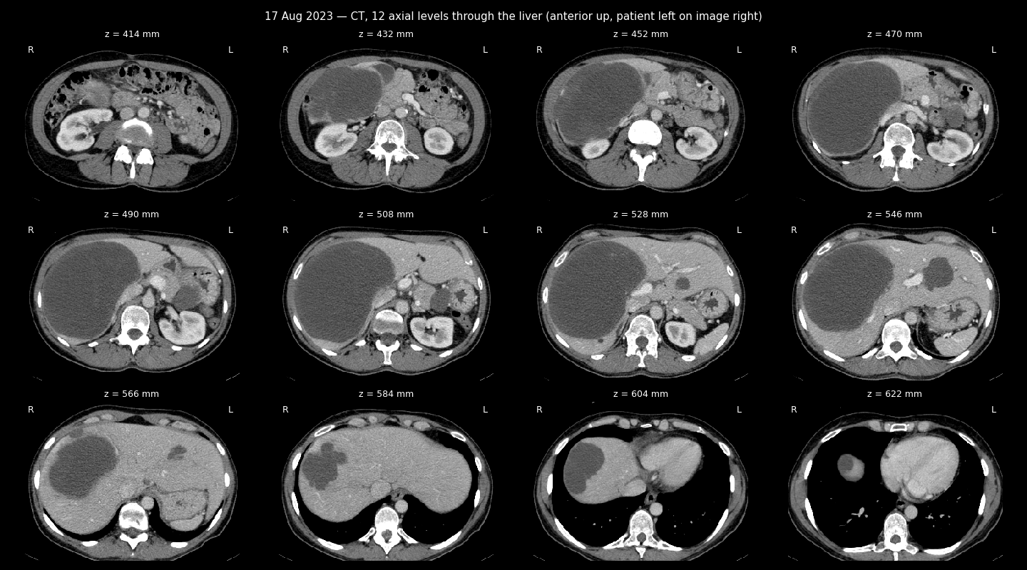 CT sheet