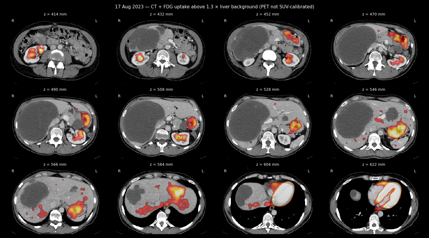PET/CT sheet