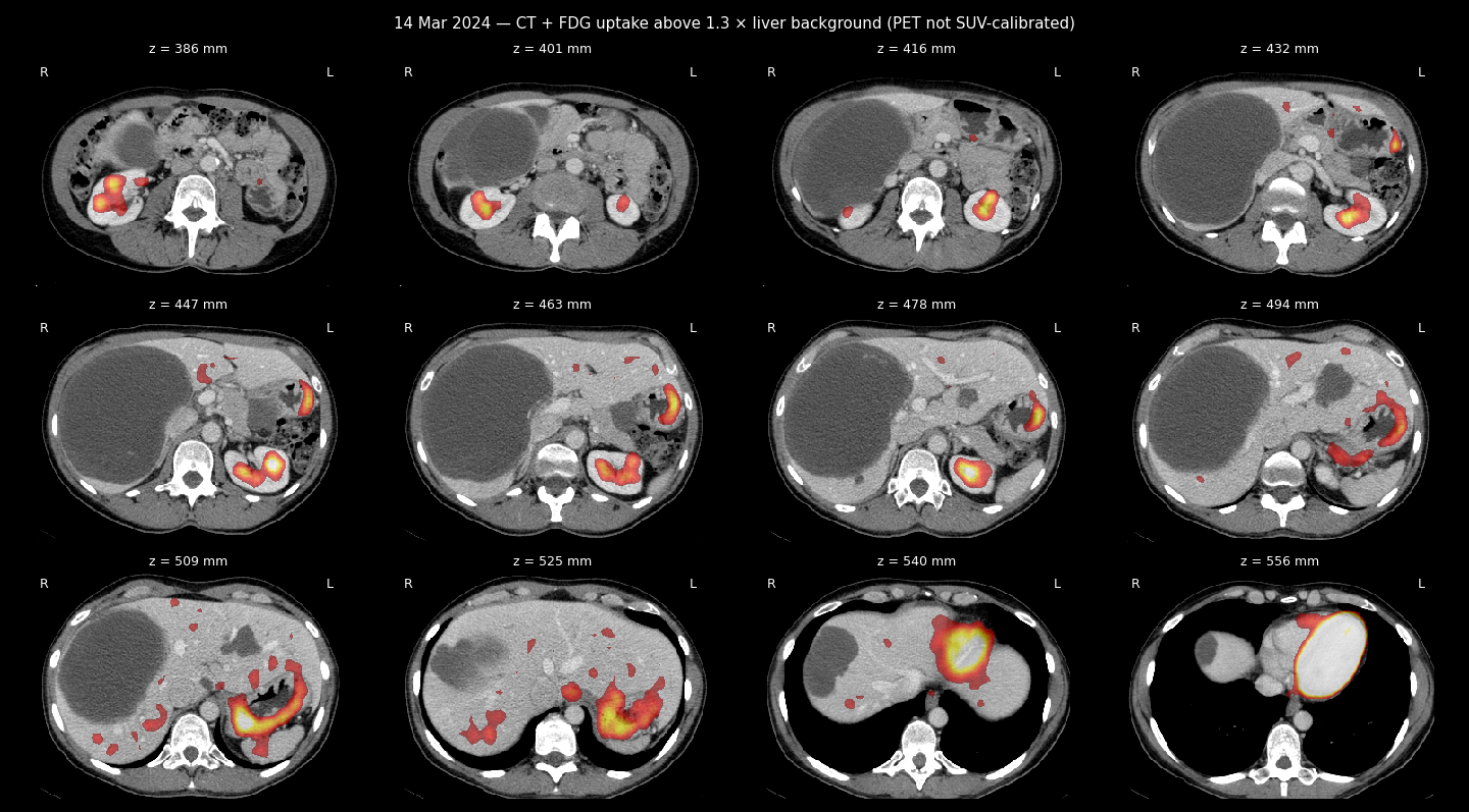 PET/CT sheet