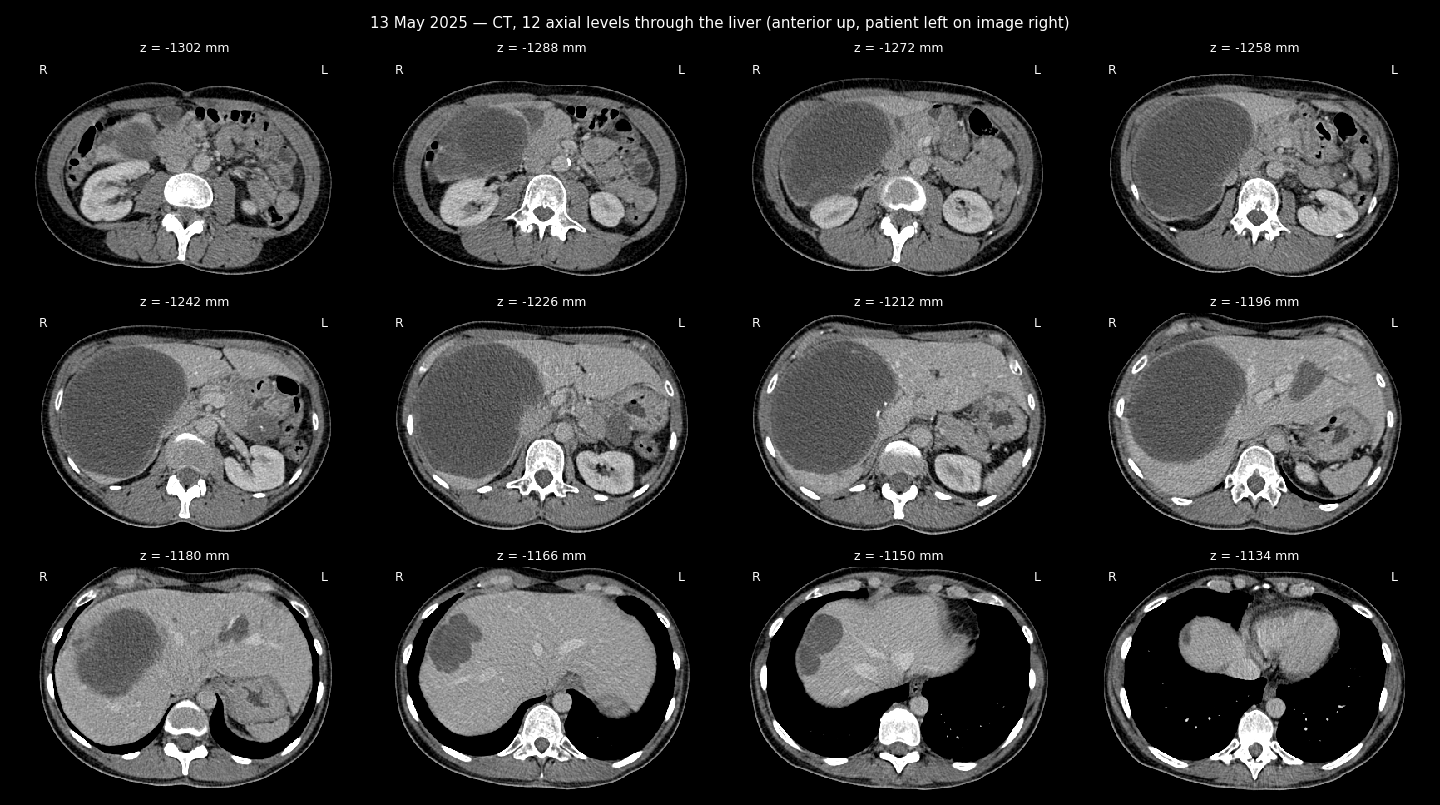 CT sheet