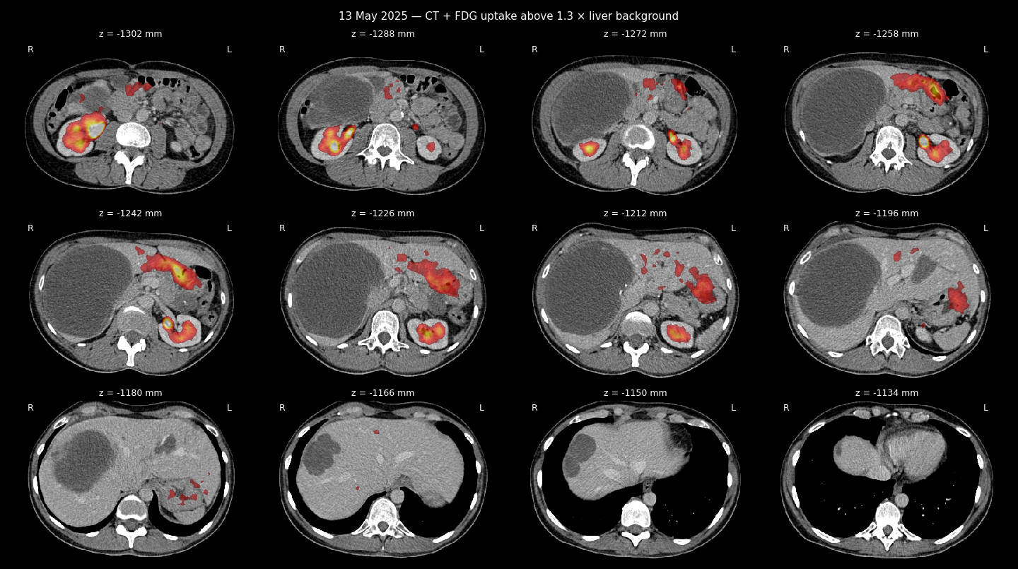 PET/CT sheet