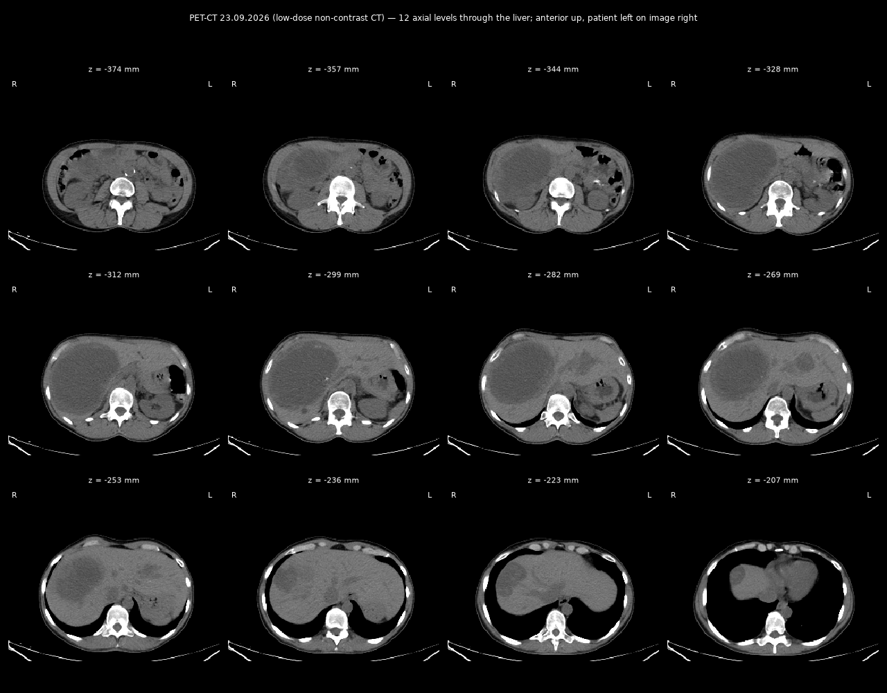 CT sheet