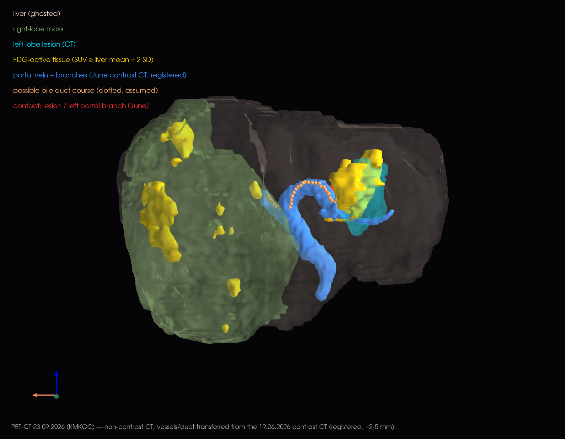 3D anterior view