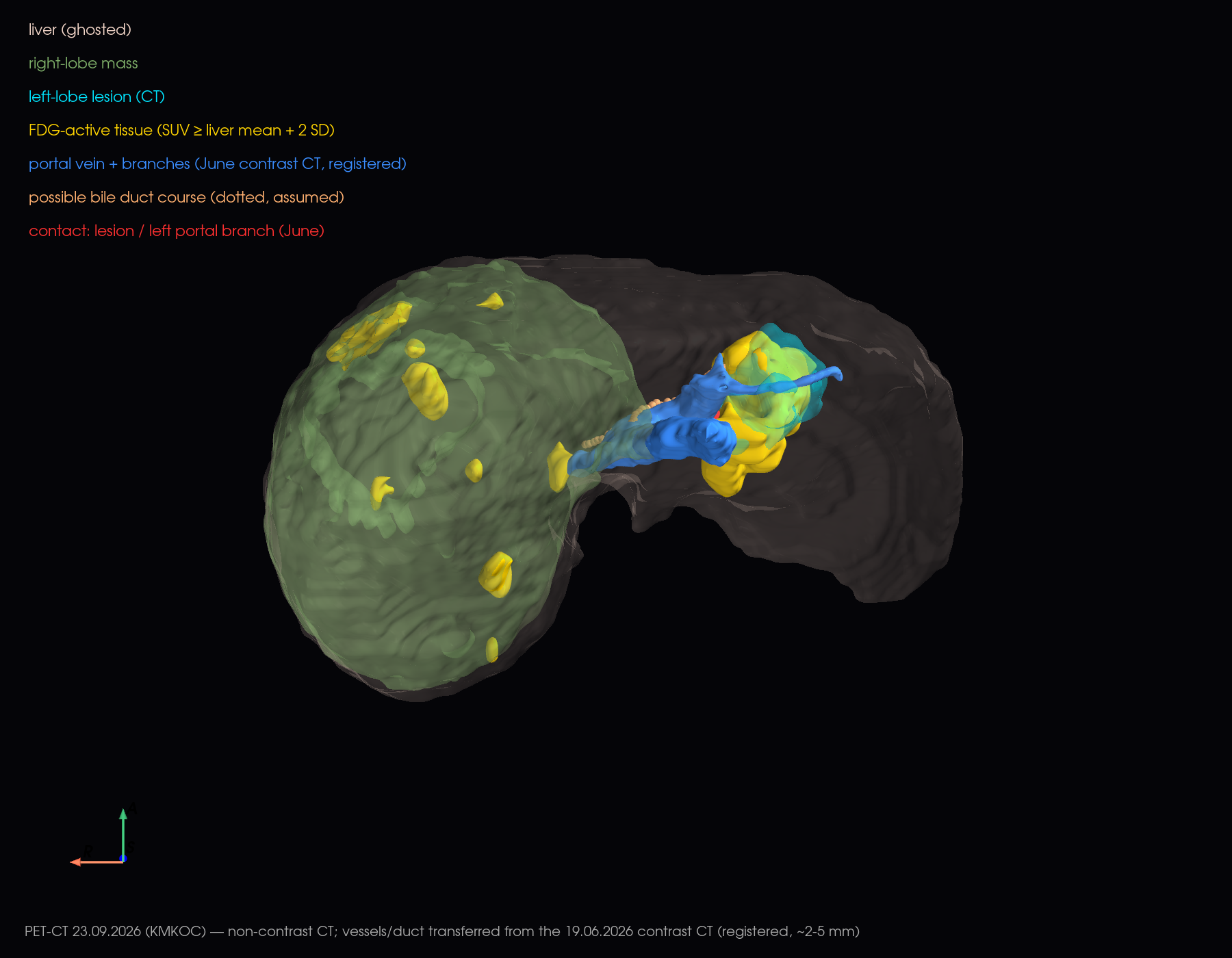 3D inferior view