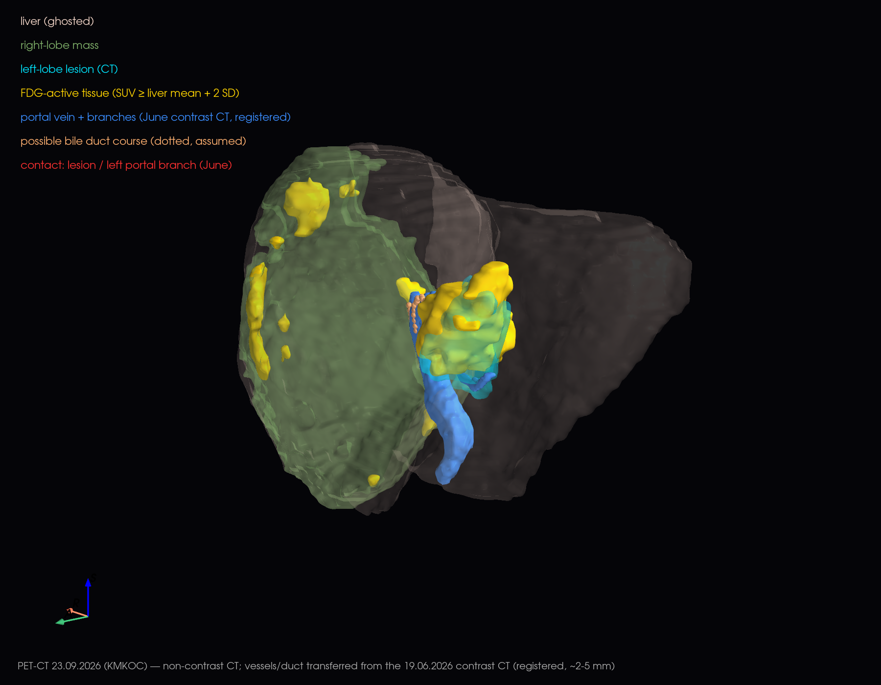 3D left anterior oblique