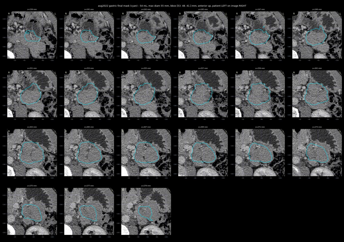 gastric trace aug2022