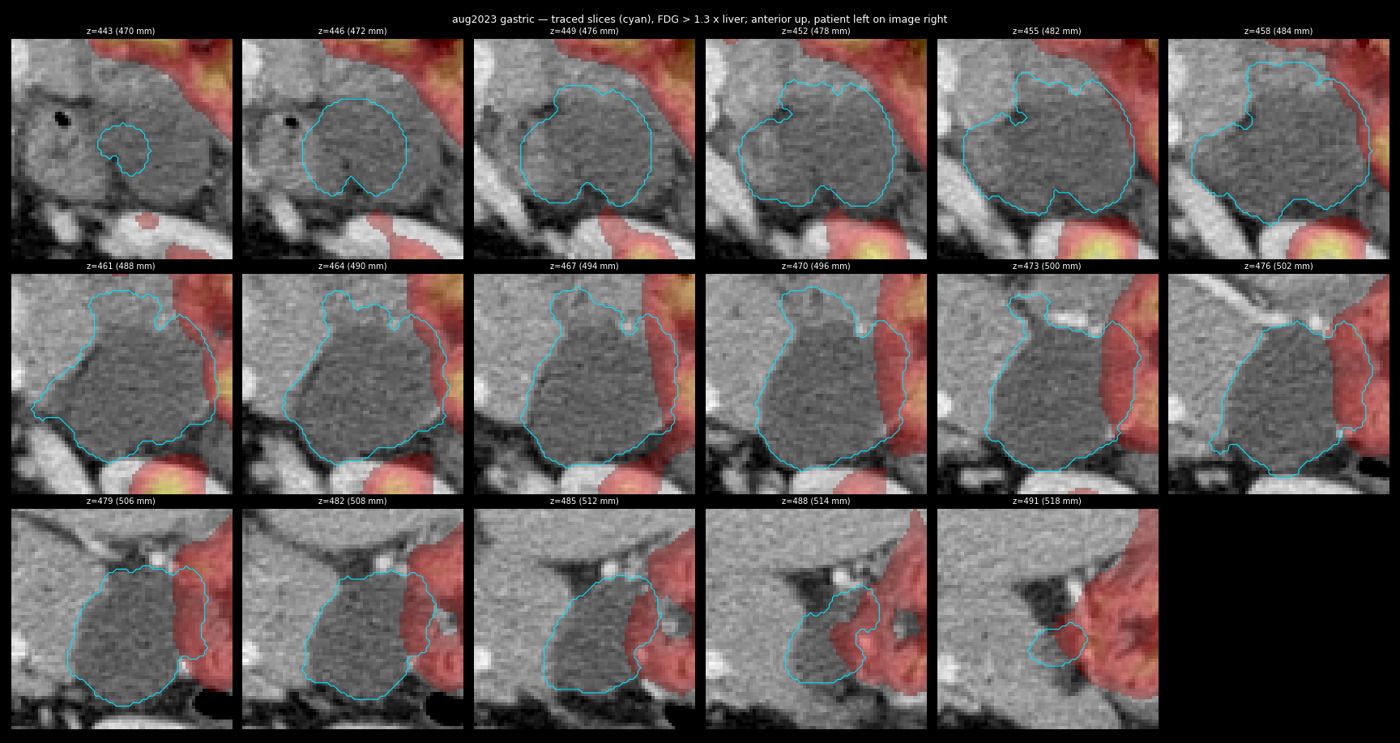 gastric trace aug2023