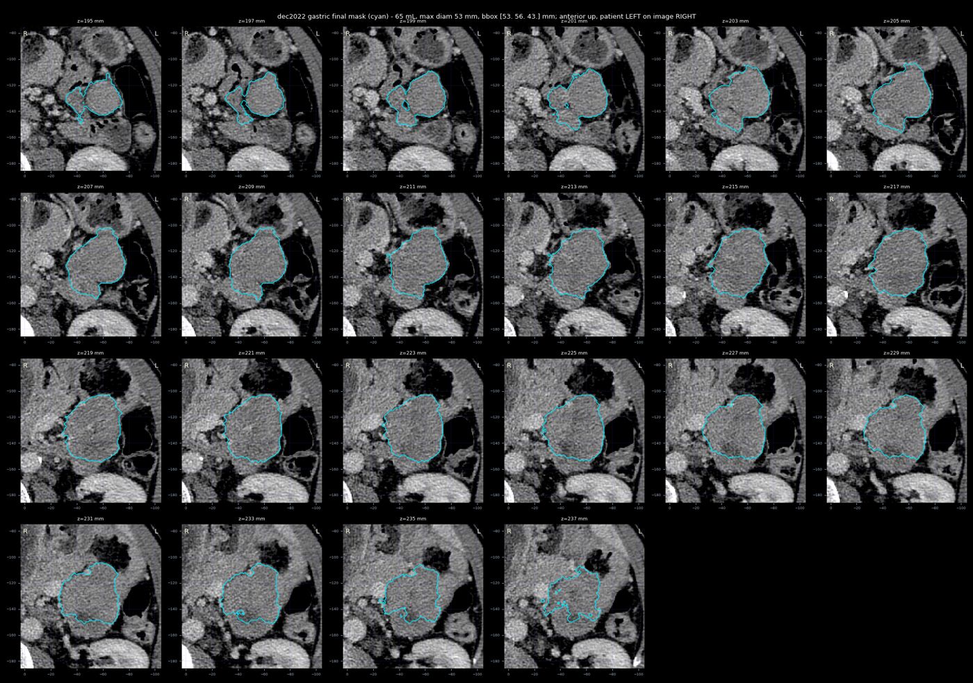 gastric trace dec2022