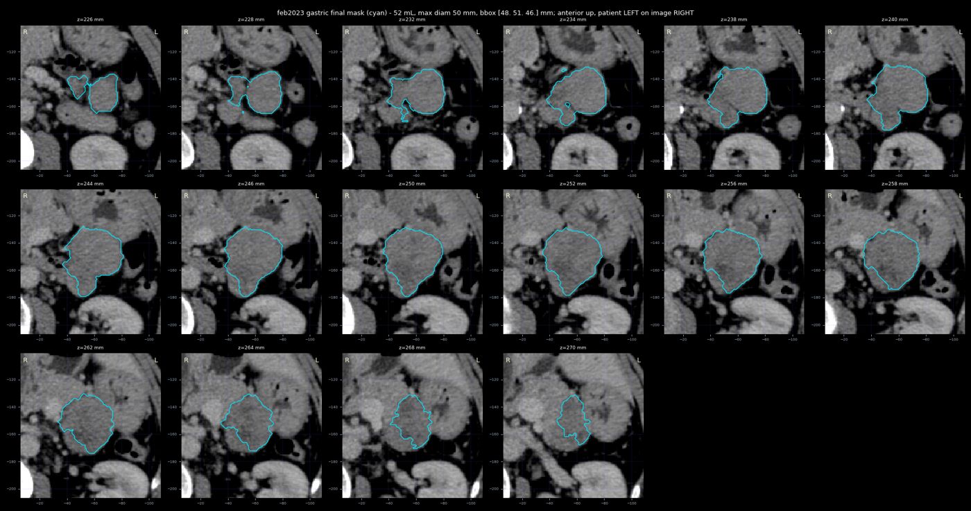gastric trace feb2023