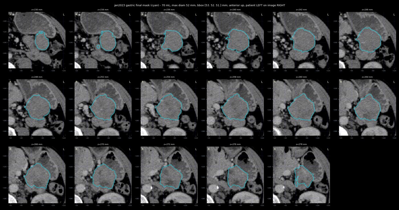 gastric trace jan2023
