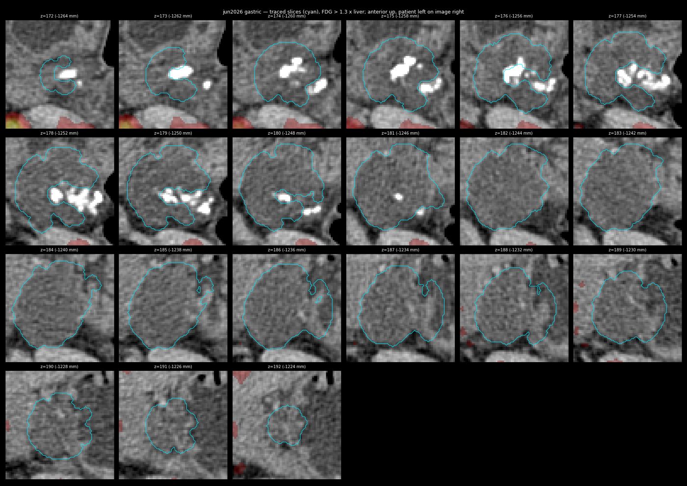 gastric trace jun2026
