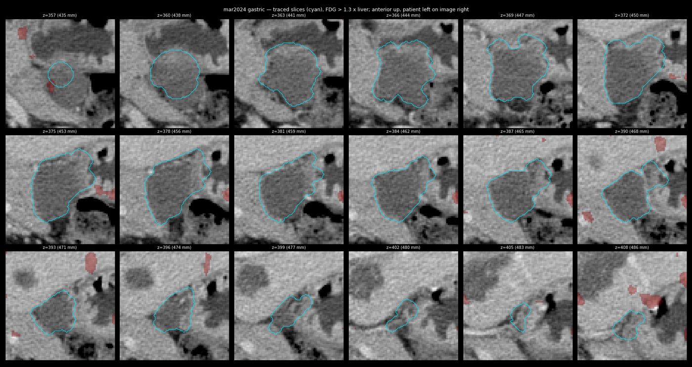 gastric trace mar2024
