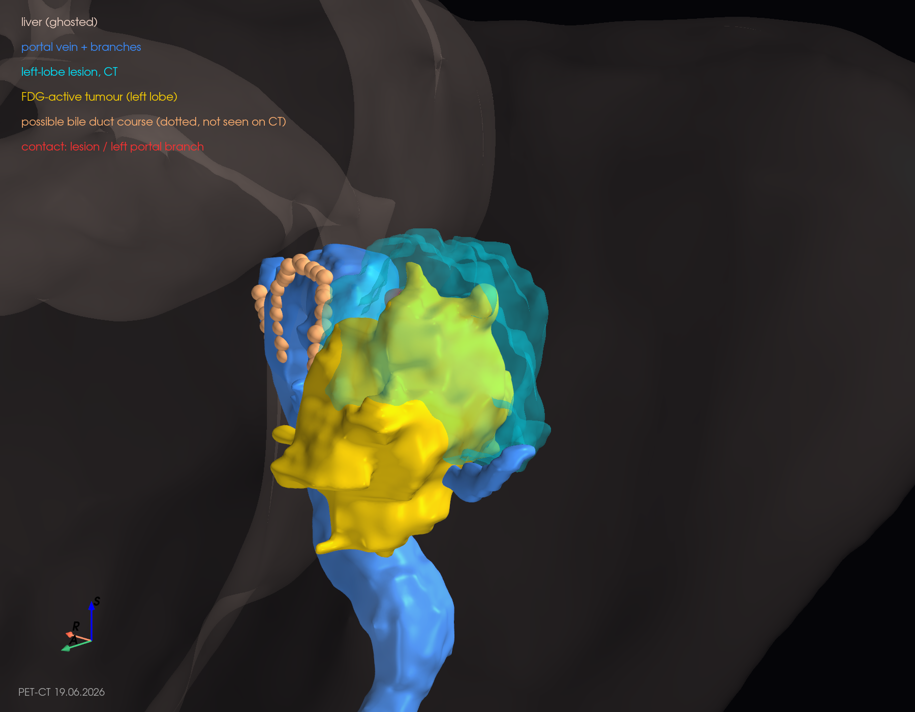 3D close-up